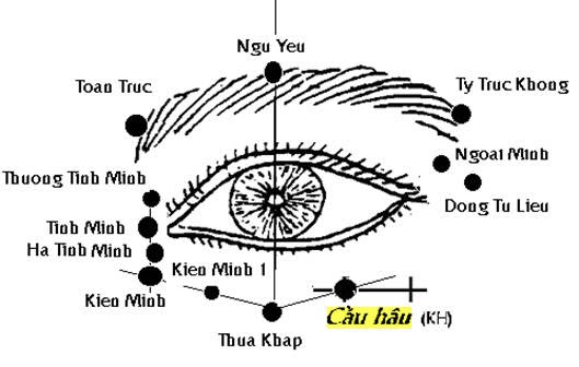 Huyệt Cầu Hậu - Y CỔ TRUYỀN
