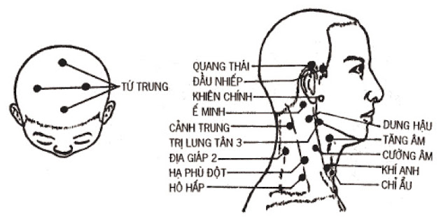 Huyệt Ế Minh - Y CỔ TRUYỀN