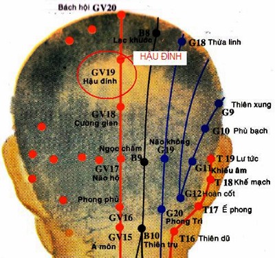Huyệt Hậu Đỉnh - Y CỔ TRUYỀN