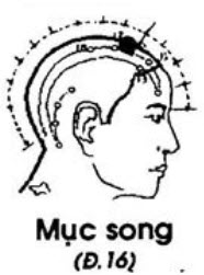 Huyệt Mục Song - Y CỔ TRUYỀN