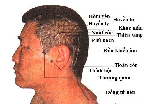 Huyệt Thính Hội - Y CỔ TRUYỀN