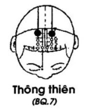Huyệt Thông Thiên - Y CỔ TRUYỀN