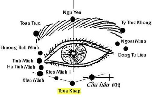 Huyệt Thừa Khấp - Y CỔ TRUYỀN
