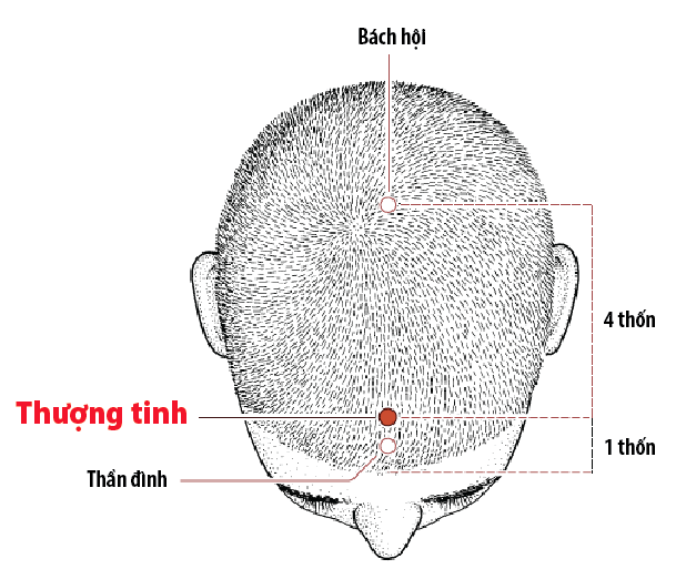 Huyệt Thượng Tinh - Y CỔ TRUYỀN