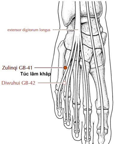 Huyệt Túc Lâm Khấp - Y CỔ TRUYỀN