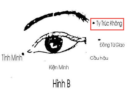 Huyệt Ty Trúc Không - Y CỔ TRUYỀN